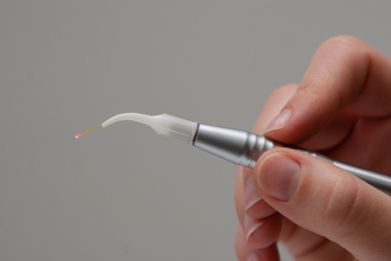 a dentist holding a laser for gum disease treatment.