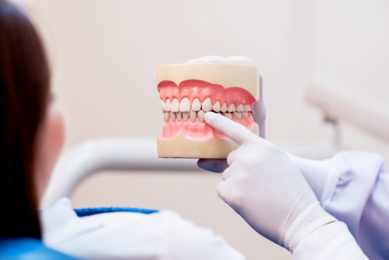 a periodontist showing a patient a full mouth dental implant model.