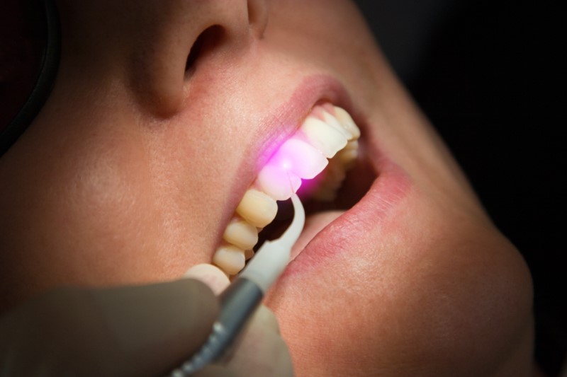 a dental implant patient being treated for gum disease.