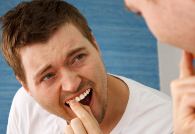 a dental implant patient with a cracked and loose tooth needing a dental implant.