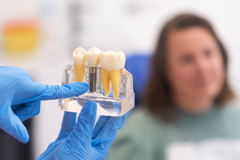 a dental implants dentist discussing a dental implant tooth replacement with a patient.