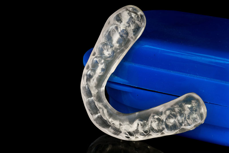 dental-night-guard model