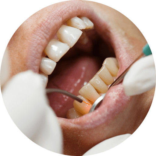 dental-patient-undergoing-laser-treatment