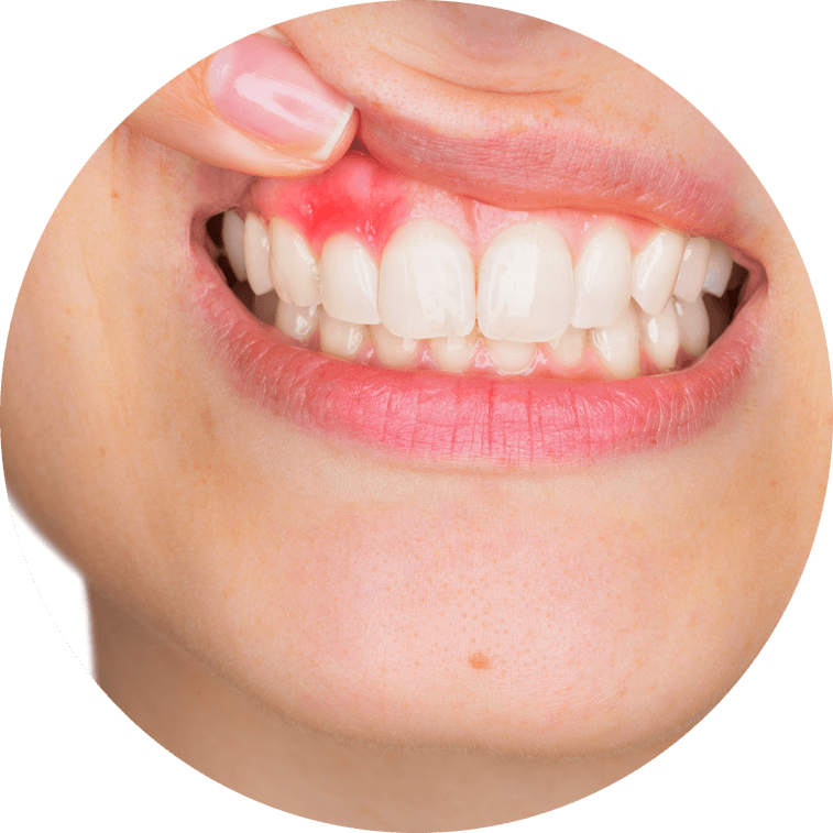 dental-patient-with-gum-disease