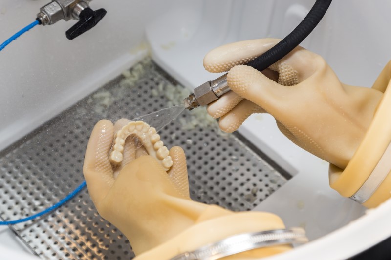 a dental implant dentist cleans a 3d printed full mouth dental implant prosthesis.
