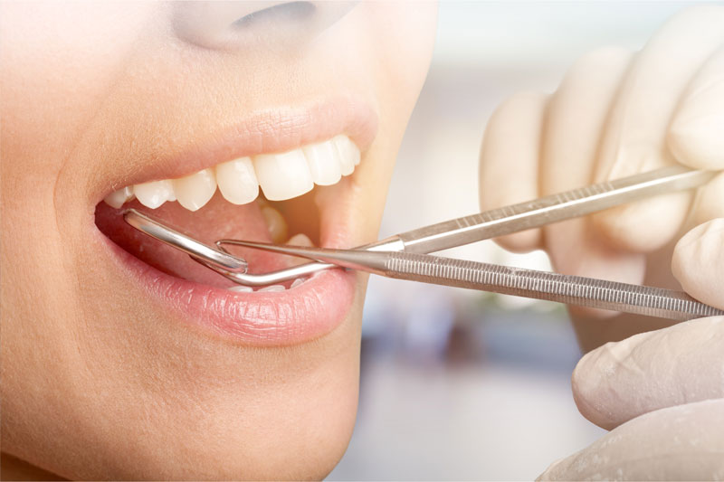 Dental tools in patient’s mouth; doctor is working on the teeth