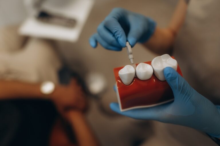 A person in blue gloves holds a dental teeth model and demonstrates a procedure with a tool, possibly an implant, as another person appears blurred in the background.